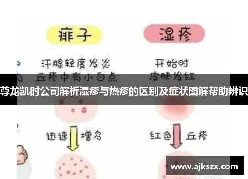 尊龙凯时公司解析湿疹与热疹的区别及症状图解帮助辨识